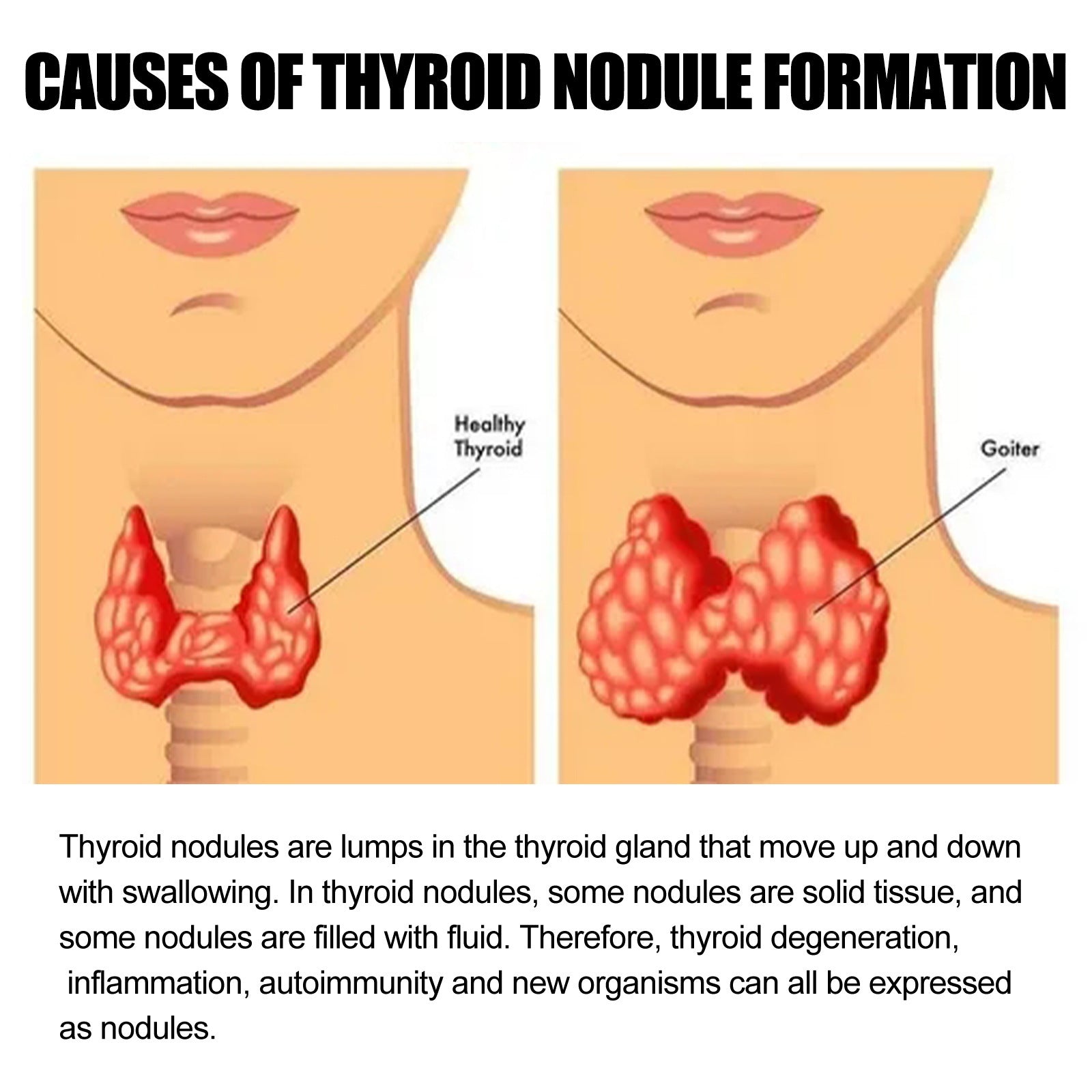 Thyroid Lymph Health Care Sticker