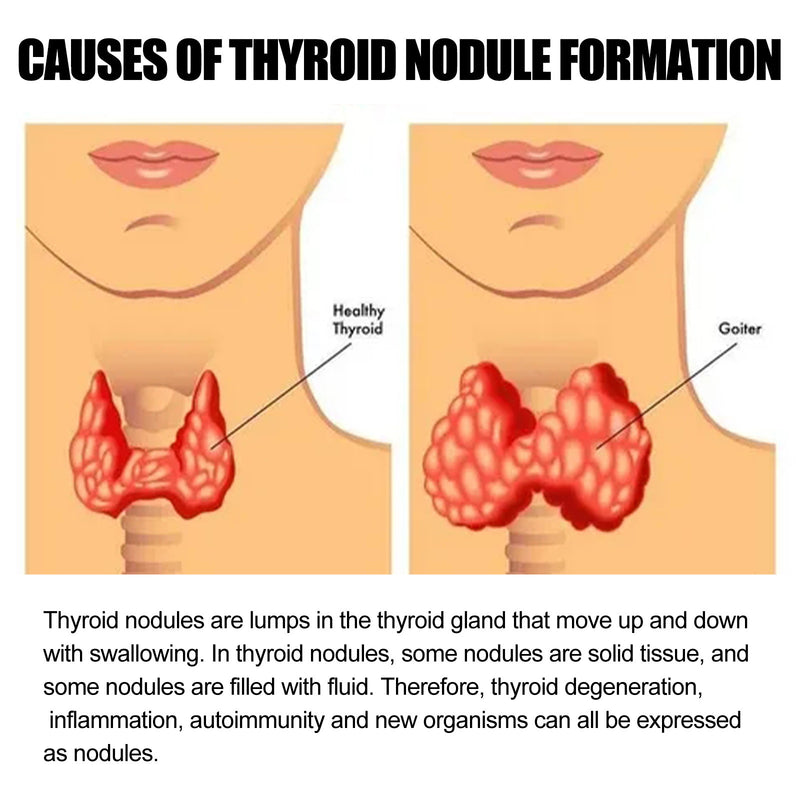 Autocollant de soins de santé pour la thyroïde et la lymphe